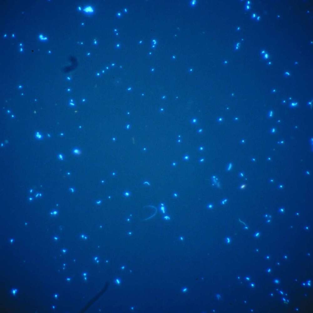 luminousplankton